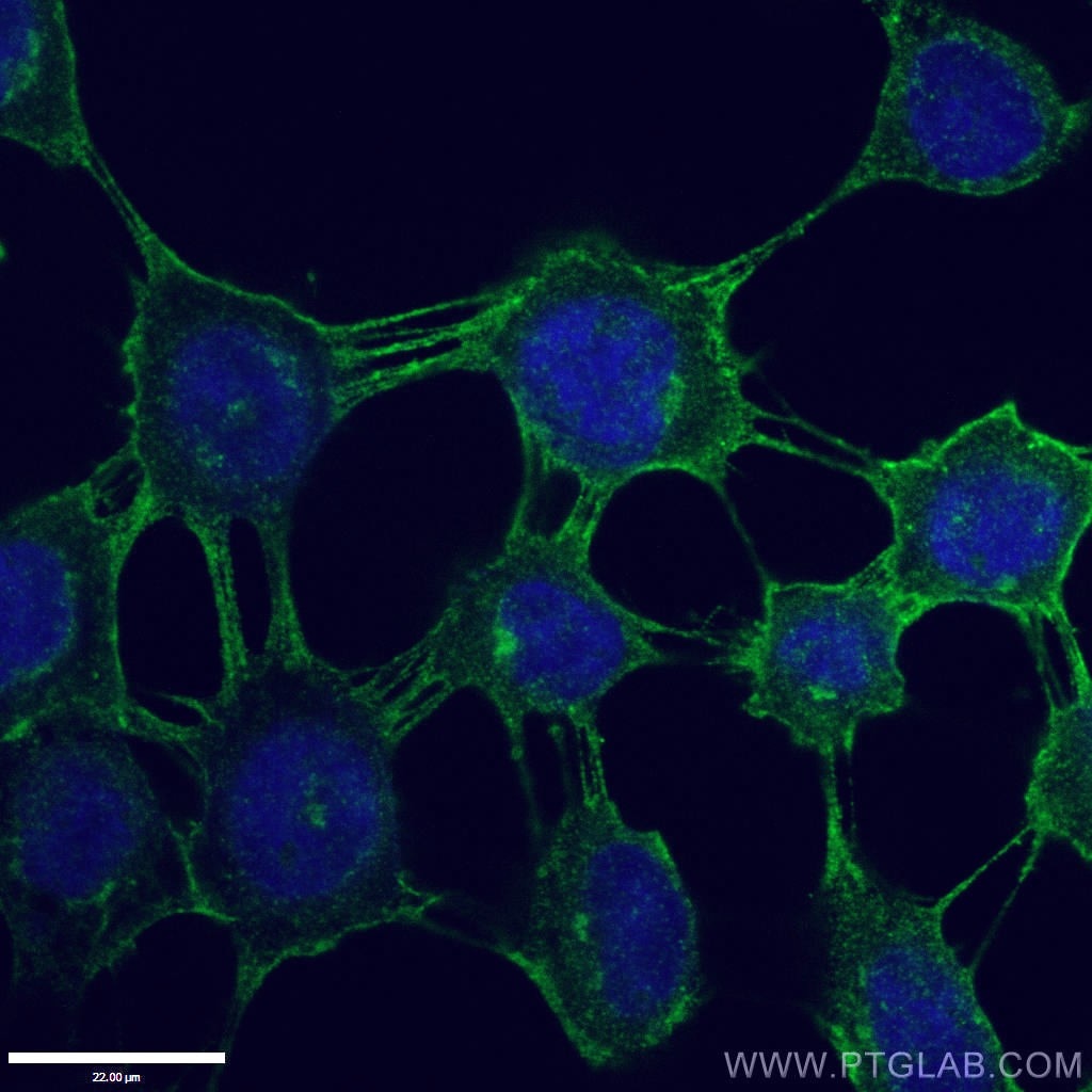 Immunofluorescence (IF) / fluorescent staining of A431 cells using P-cadherin Polyclonal antibody (13773-1-AP)