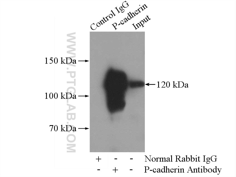 Immunoprecipitation (IP) experiment of A431 cells using P-cadherin Polyclonal antibody (13773-1-AP)