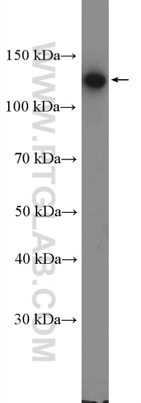 Western Blot (WB) analysis of A431 cells using P-cadherin Polyclonal antibody (13773-1-AP)