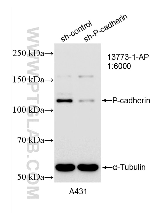 WB analysis of A431 using 13773-1-AP Western Blot (WB) analysis of A431 cells using P-cadherin Polyclonal antibody (13773-1-AP)