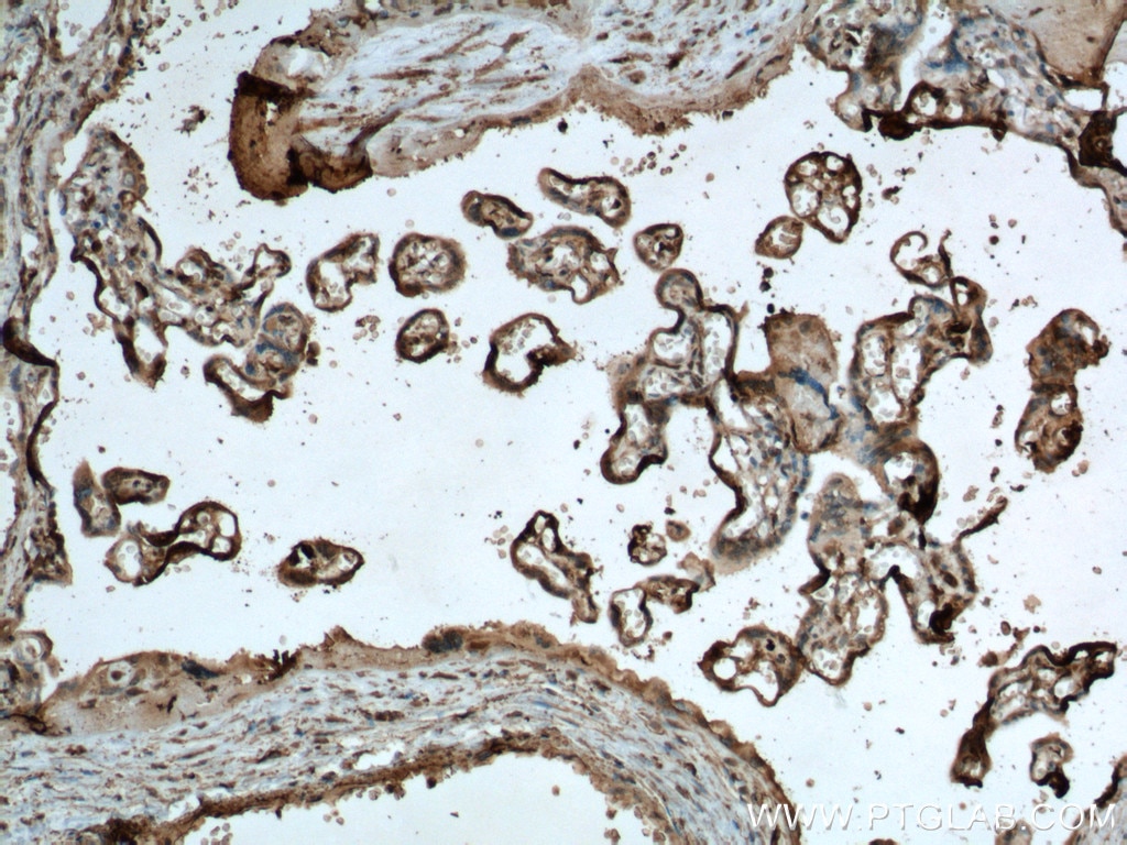Immunohistochemistry (IHC) staining of human placenta tissue using P-cadherin Monoclonal antibody (66295-1-Ig)