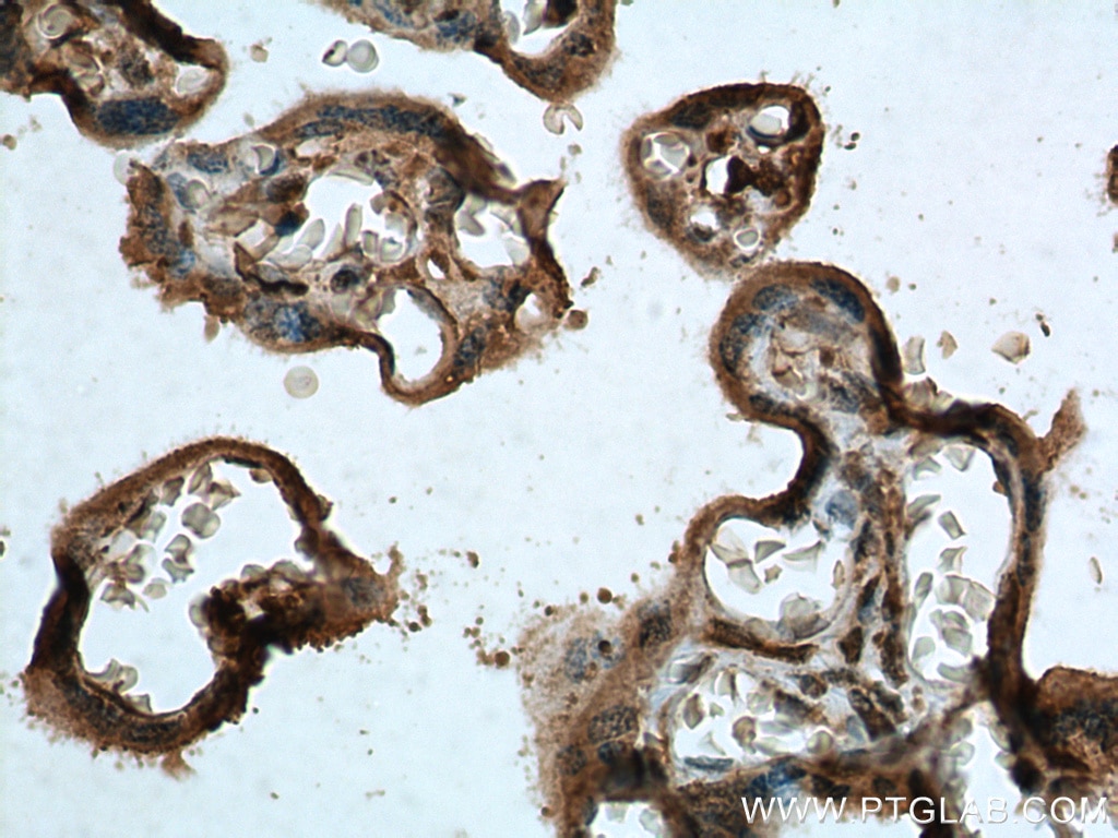 Immunohistochemistry (IHC) staining of human placenta tissue using P-cadherin Monoclonal antibody (66295-1-Ig)