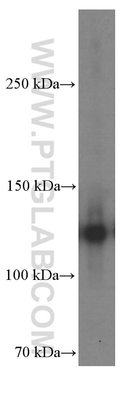 Western Blot (WB) analysis of A431 cells using P-cadherin Monoclonal antibody (66295-1-Ig)