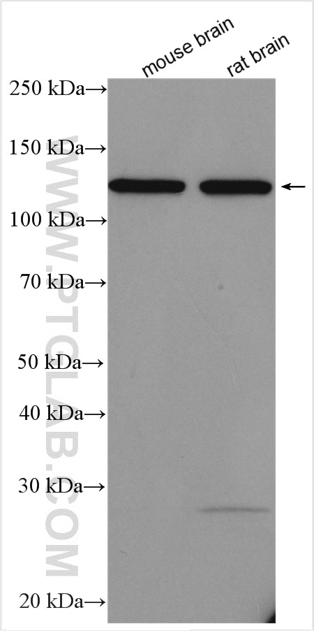 Various lysates were subjected to SDS PAGE followed by western blot with 19795-1-AP (R-cadherin antibody) at dilution of 1:800 incubated at room temperature for 1.5 hours. Western Blot (WB) analysis of various lysates using R-cadherin Polyclonal antibody (19795-1-AP)