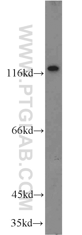 Western Blot (WB) analysis of mouse brain tissue using R-cadherin Polyclonal antibody (19795-1-AP)