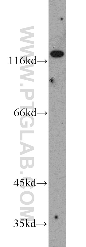 Western Blot (WB) analysis of HepG2 cells using R-cadherin Polyclonal antibody (19795-1-AP)