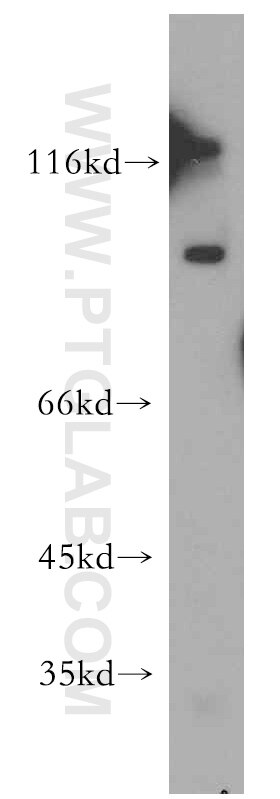 Western Blot (WB) analysis of mouse brain tissue using R-cadherin Polyclonal antibody (19795-1-AP)