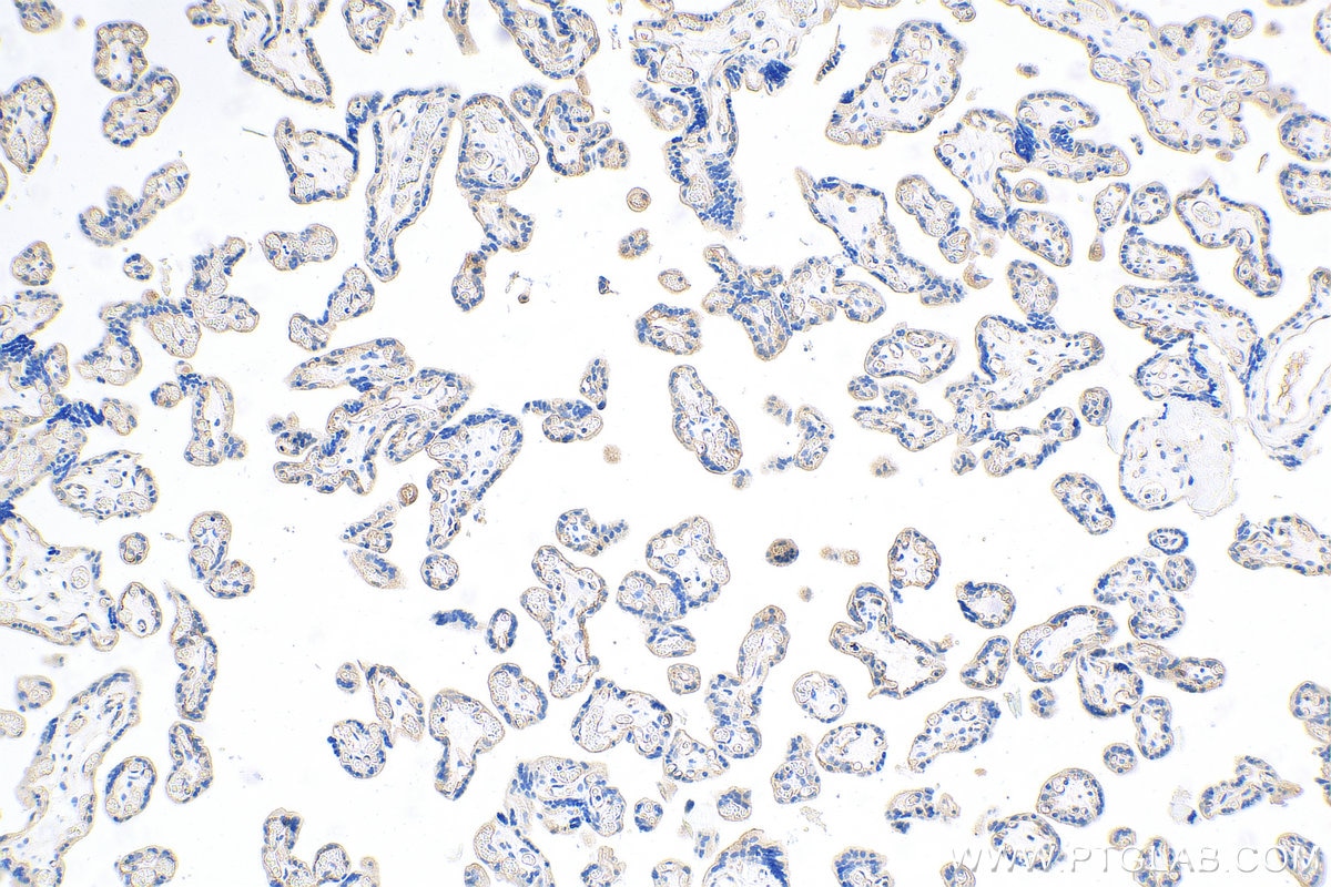 Immunohistochemistry (IHC) staining of human placenta tissue using VE-cadherin Polyclonal antibody (27956-1-AP)