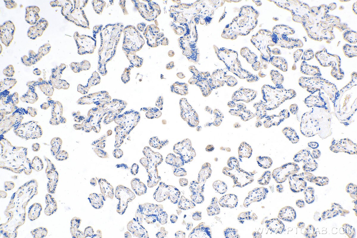 IHC staining of human placenta using 27956-1-AP