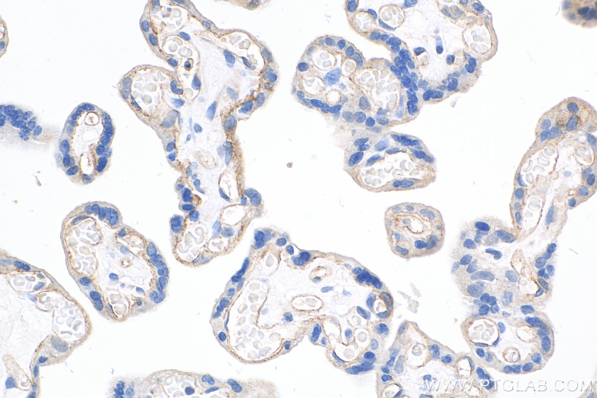 IHC staining of human placenta using 27956-1-AP