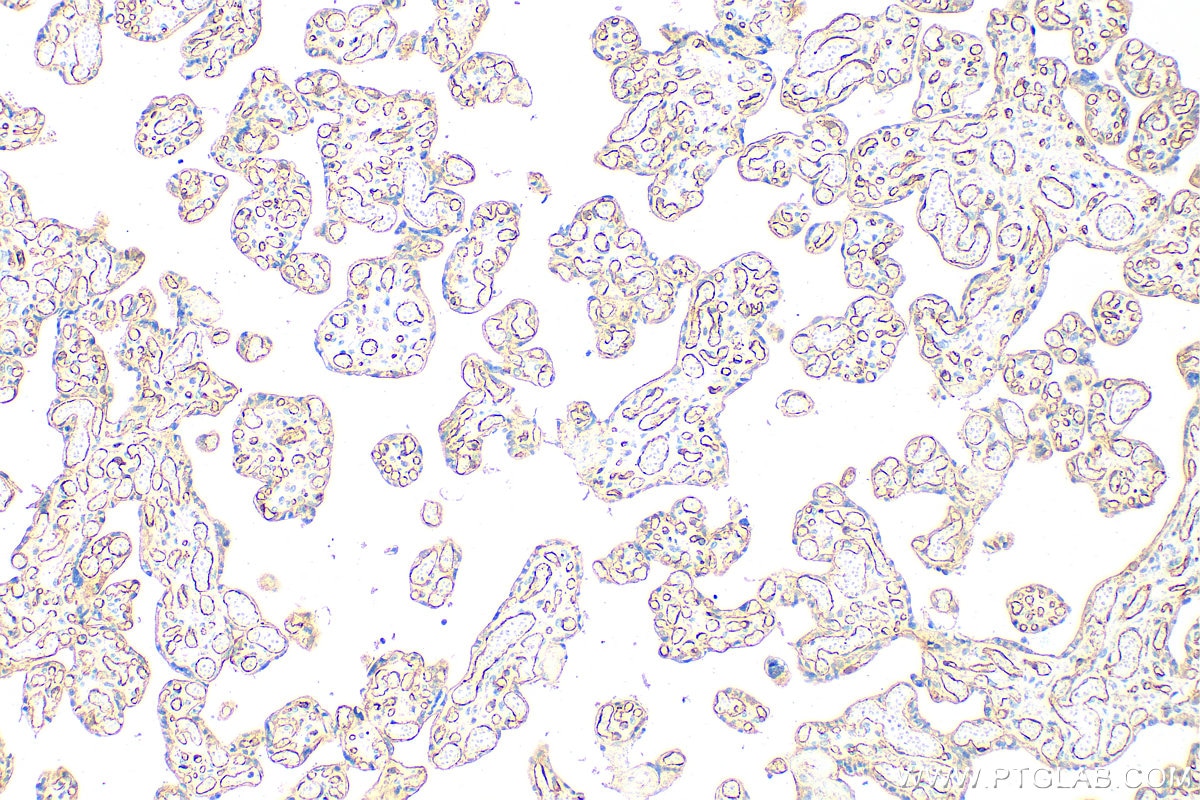 Immunohistochemistry (IHC) staining of human placenta tissue using VE-cadherin Polyclonal antibody (27956-1-AP)