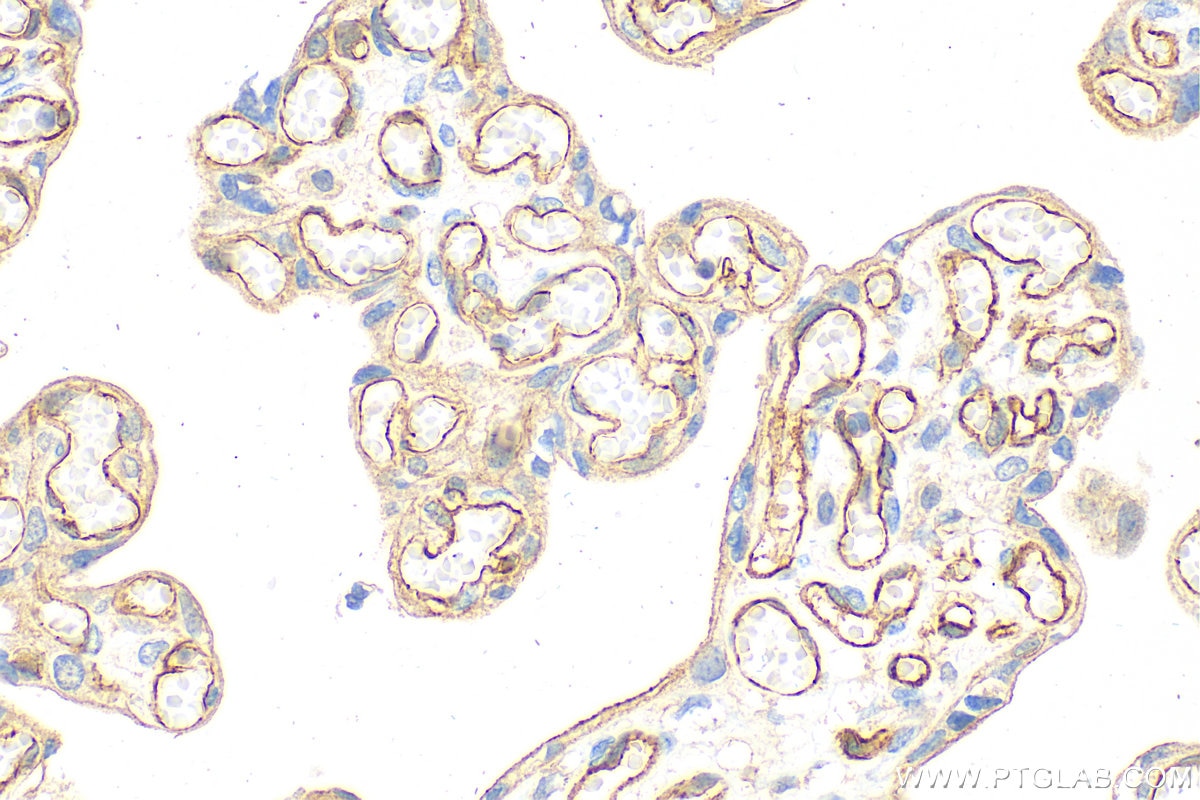 Immunohistochemistry (IHC) staining of human placenta tissue using VE-cadherin Polyclonal antibody (27956-1-AP)