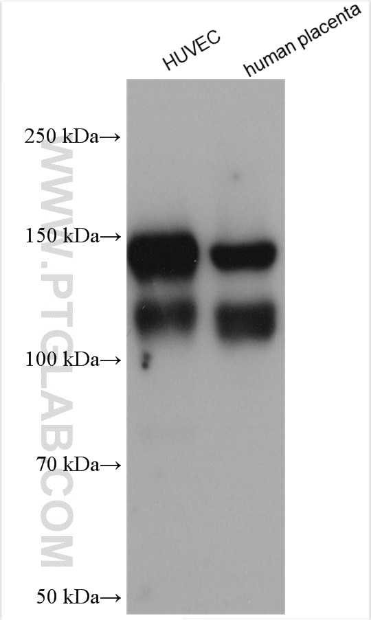 Western Blot (WB) analysis of various lysates using VE-cadherin Polyclonal antibody (27956-1-AP)