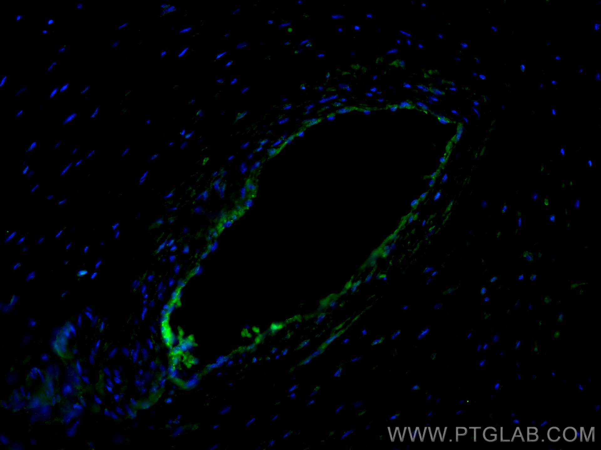 Immunofluorescence (IF) / fluorescent staining of human placenta tissue using VE-cadherin Monoclonal antibody (66804-1-Ig)