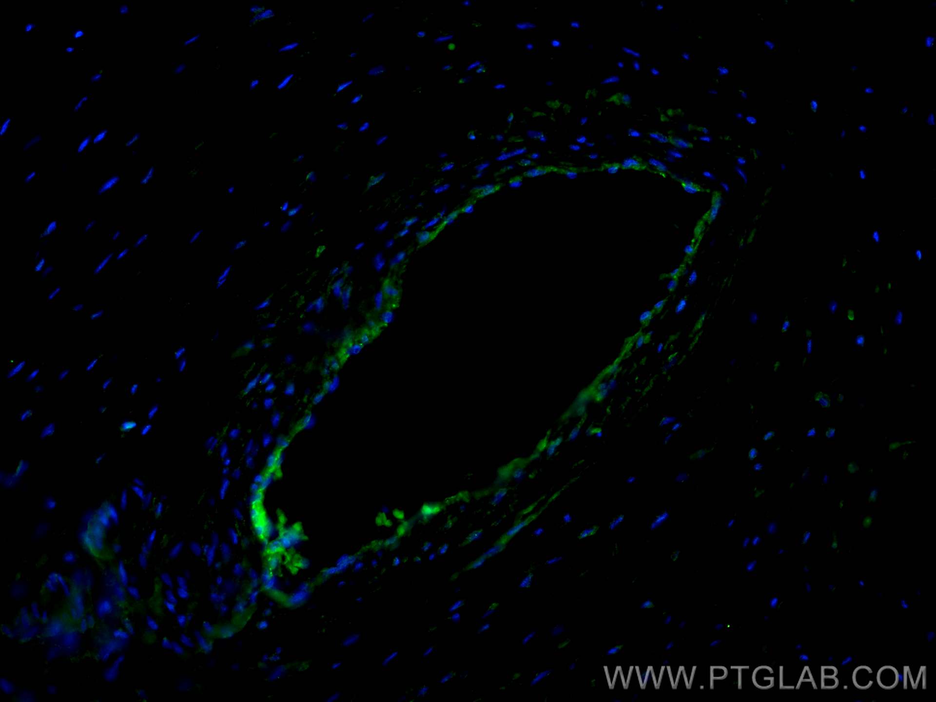 IF Staining of human placenta using 66804-1-Ig