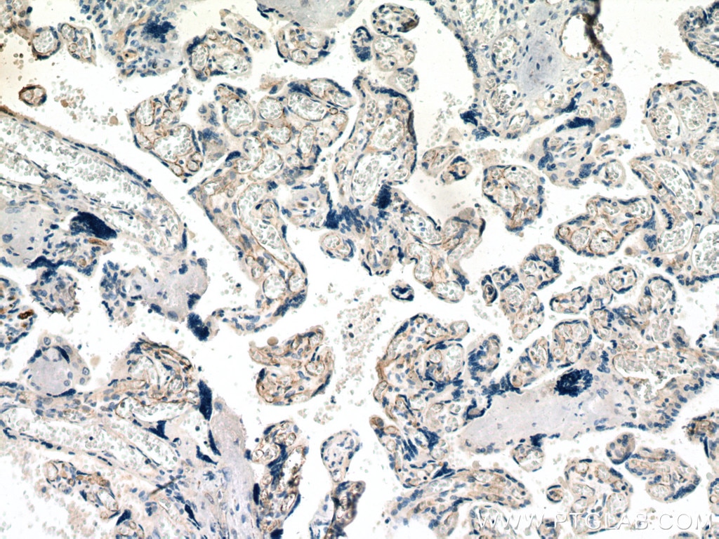 Immunohistochemistry (IHC) staining of human placenta tissue using VE-cadherin Monoclonal antibody (66804-1-Ig)