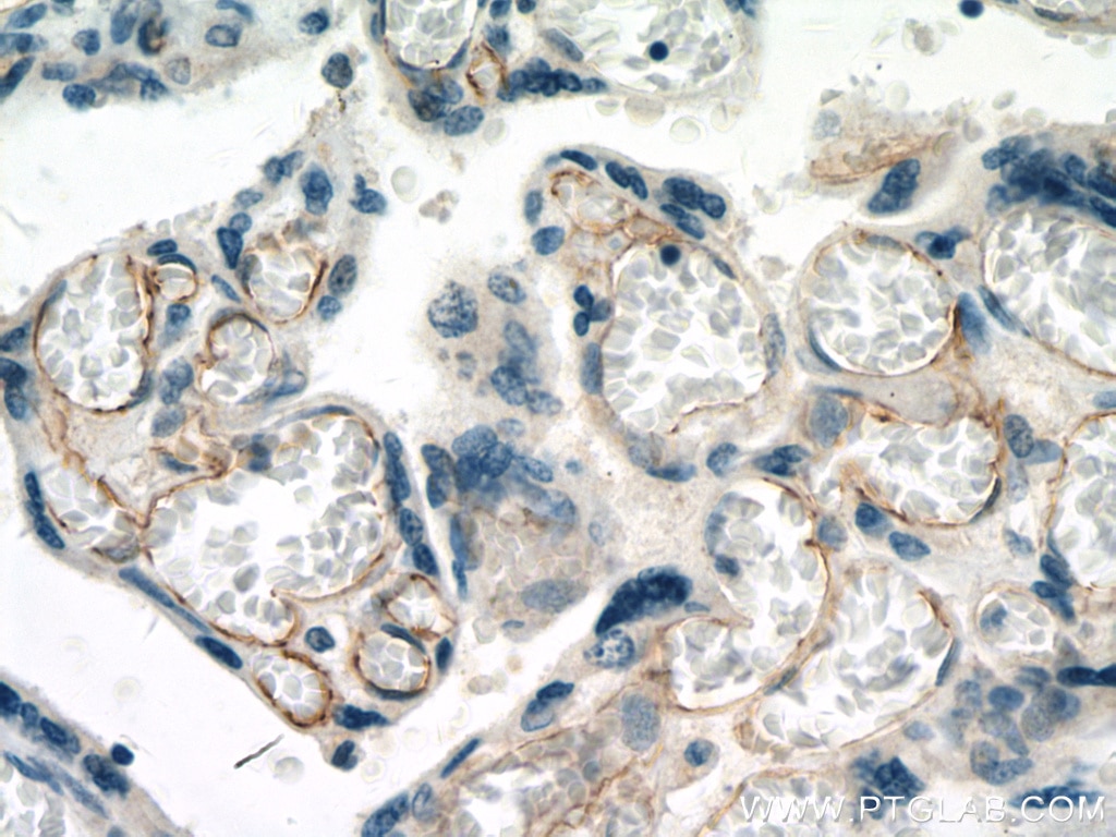 IHC staining of human placenta using 66804-1-Ig