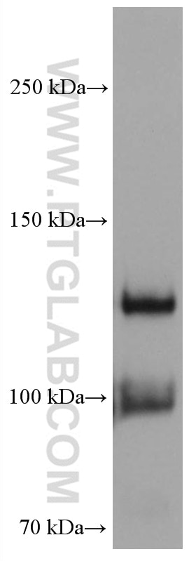 Western Blot (WB) analysis of human placenta tissue using VE-cadherin Monoclonal antibody (66804-1-Ig)