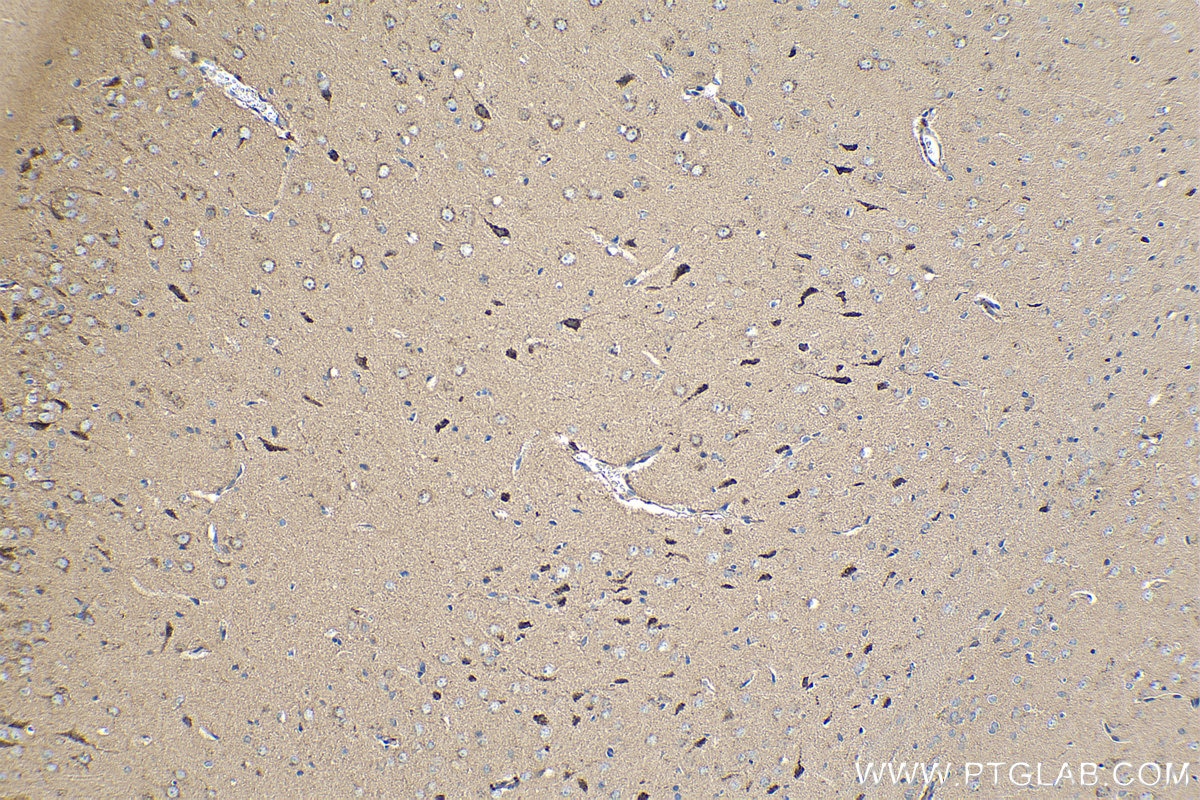 Immunohistochemistry (IHC) staining of rat brain tissue using Cadherin-7 Polyclonal antibody (13598-1-AP)