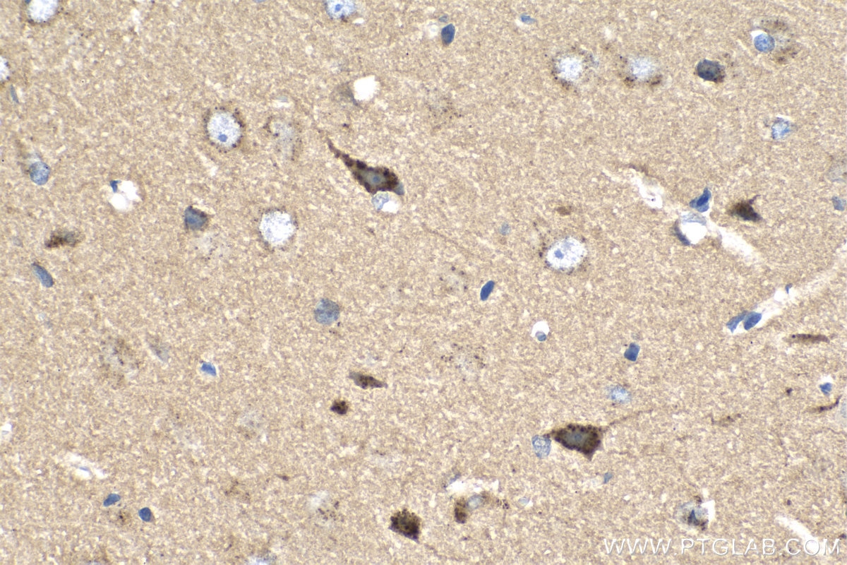 IHC staining of rat brain using 13598-1-AP
