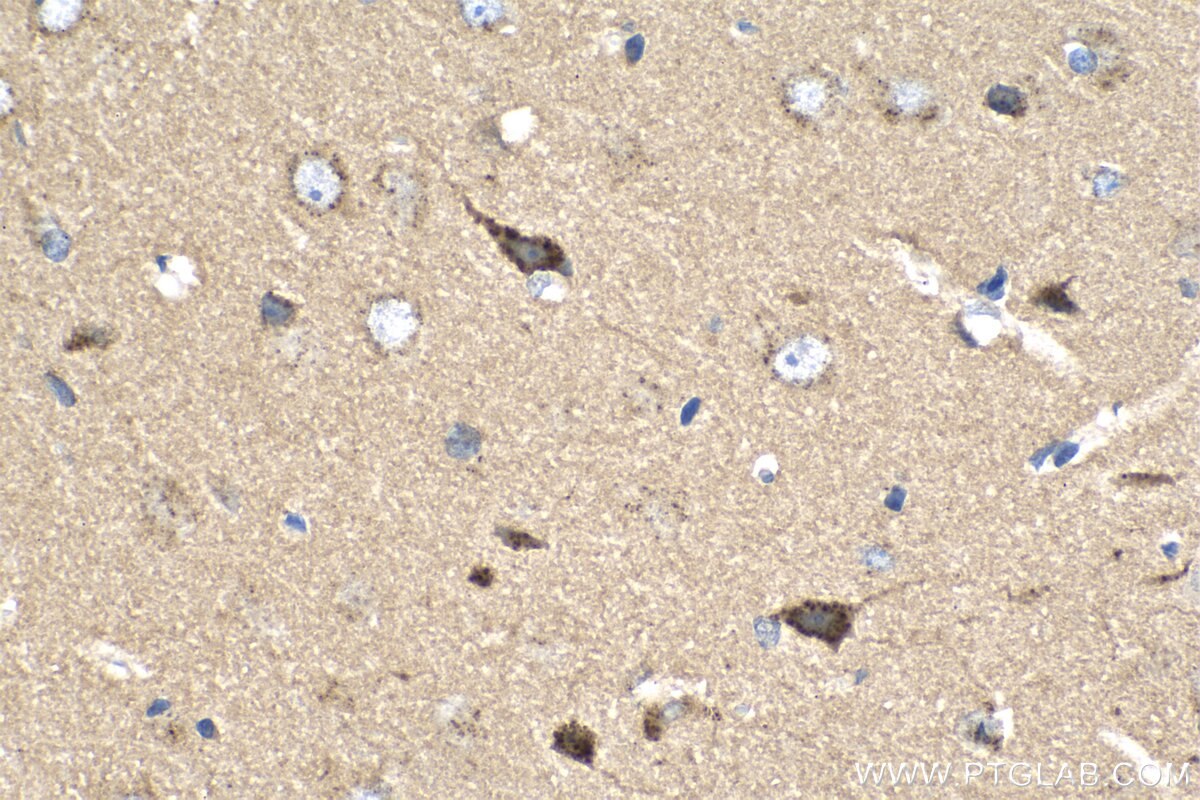 Immunohistochemistry (IHC) staining of rat brain tissue using Cadherin-7 Polyclonal antibody (13598-1-AP)