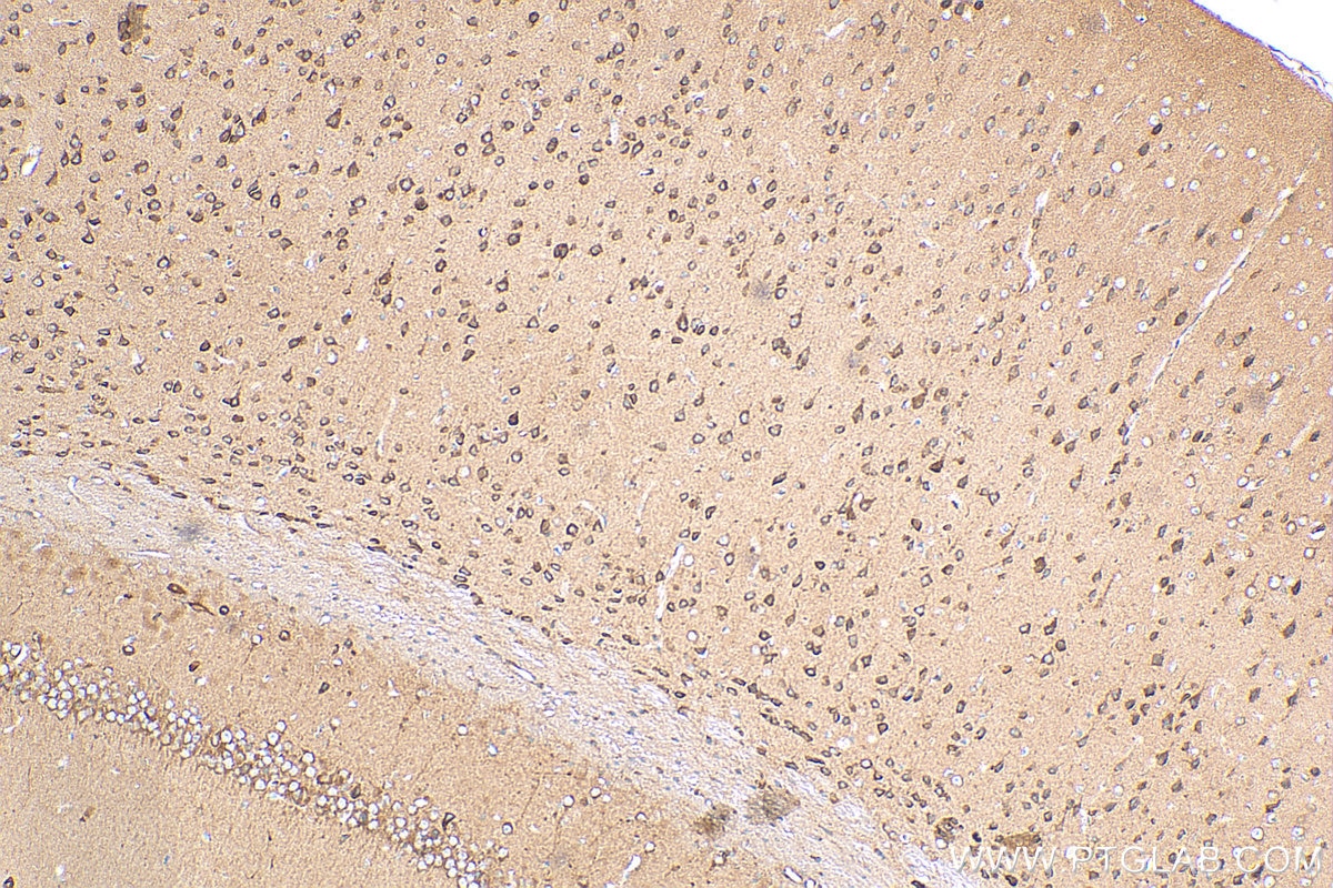 Immunohistochemistry (IHC) staining of mouse brain tissue using Cadherin-7 Polyclonal antibody (13598-1-AP)