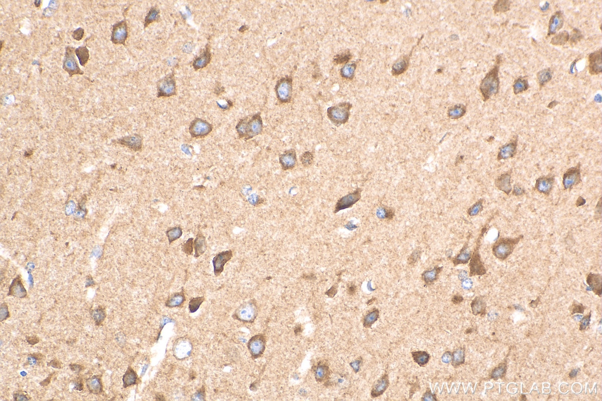 Immunohistochemistry (IHC) staining of mouse brain tissue using Cadherin-7 Polyclonal antibody (13598-1-AP)