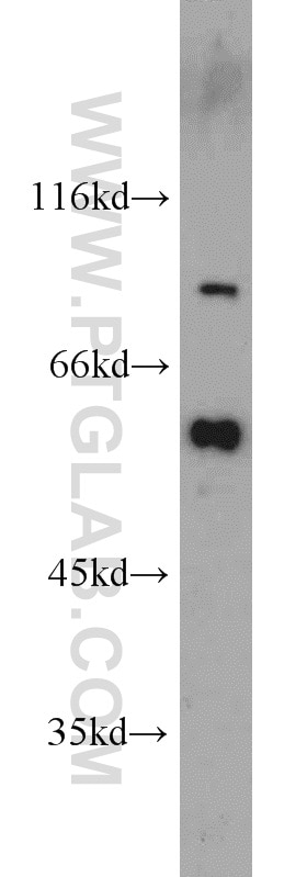 Western Blot (WB) analysis of A549 cells using Cadherin-7 Polyclonal antibody (13598-1-AP)