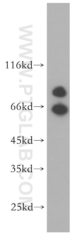 Western Blot (WB) analysis of A549 cells using Cadherin-7 Polyclonal antibody (13598-1-AP)