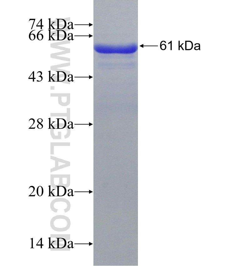 CDH7 fusion protein Ag4518 SDS-PAGE
