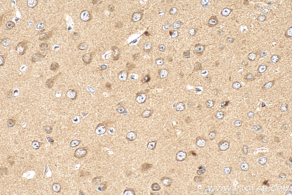 Immunohistochemistry (IHC) staining of mouse brain tissue using CDIPT Polyclonal antibody (22465-1-AP)