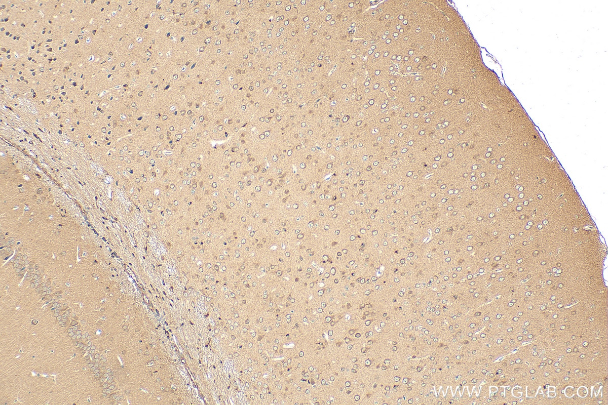Immunohistochemistry (IHC) staining of mouse brain tissue using CDIPT Polyclonal antibody (22465-1-AP)
