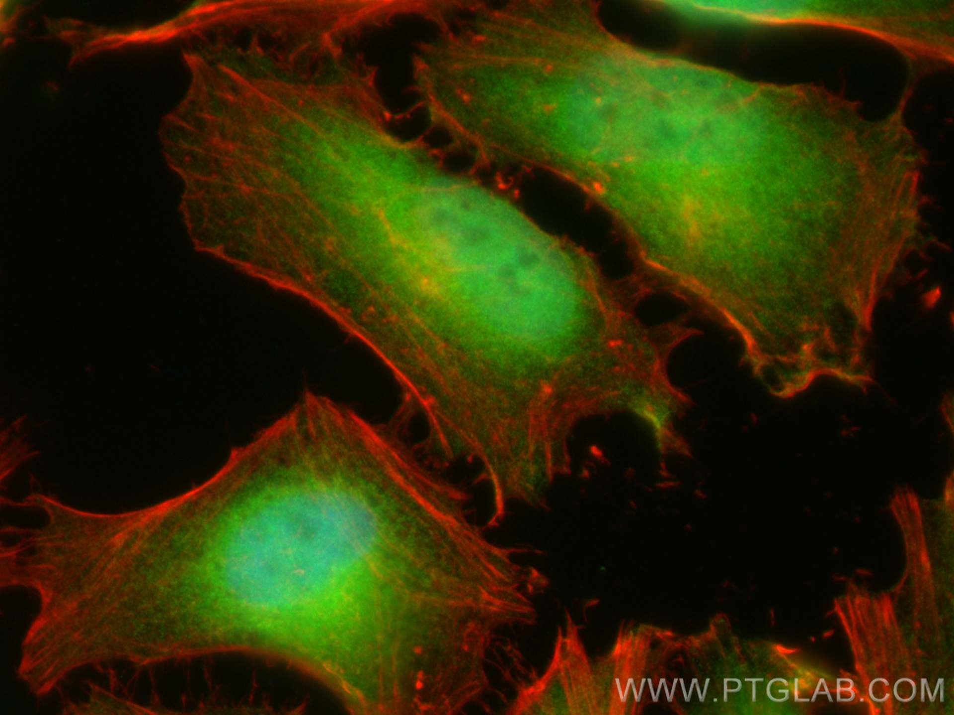 Immunofluorescence (IF) / fluorescent staining of HeLa cells using CDK1 Polyclonal antibody (10762-1-AP)