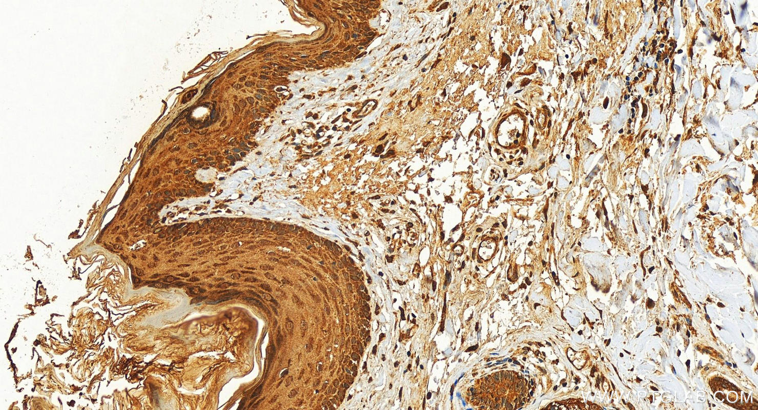 Immunohistochemistry (IHC) staining of human paracancerous tissue of skin using CDK1 Polyclonal antibody (10762-1-AP)
