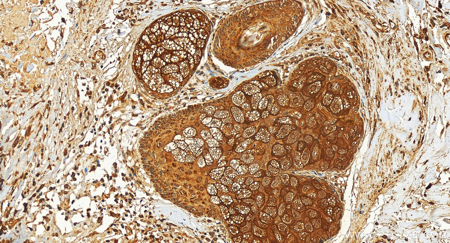 Immunohistochemistry (IHC) staining of human paracancerous tissue of skin using CDK1 Polyclonal antibody (10762-1-AP)