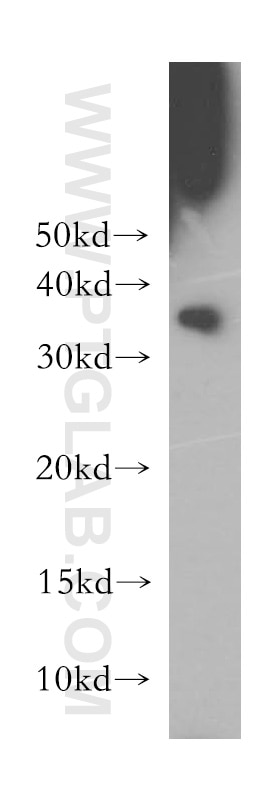 Western Blot (WB) analysis of HeLa cells using CDK1 Polyclonal antibody (10762-1-AP)