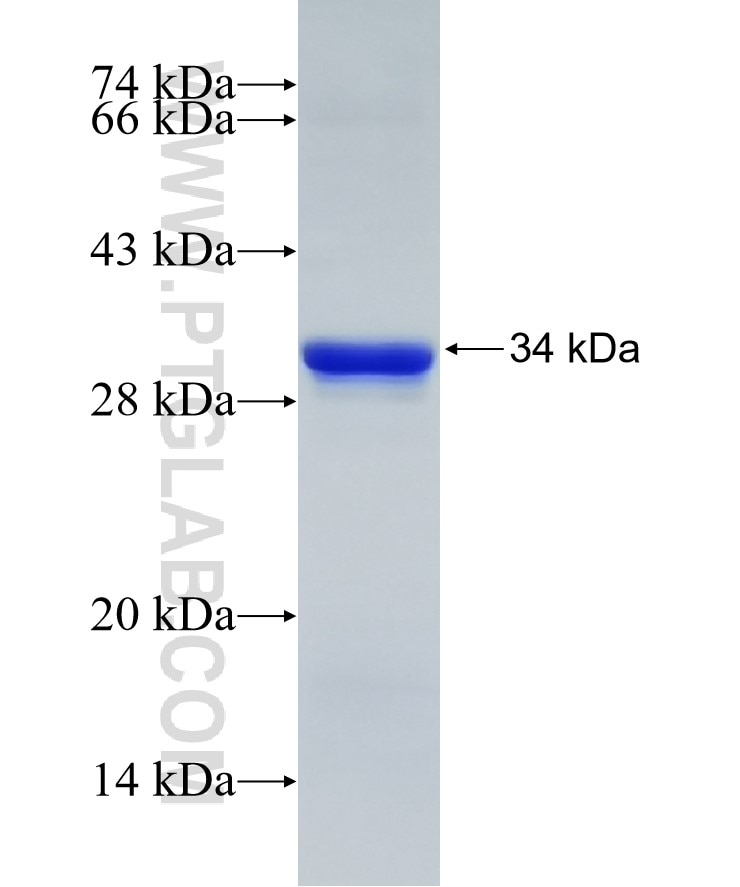 CDK1 fusion protein Ag29018 SDS-PAGE
