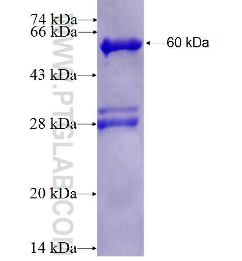 CDK1 fusion protein Ag1183 SDS-PAGE