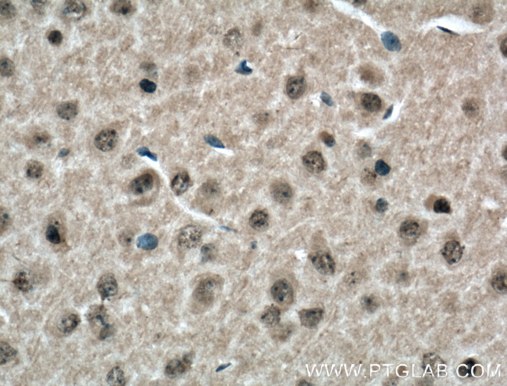 Immunohistochemistry (IHC) staining of mouse brain tissue using CDK10 Polyclonal antibody (17182-1-AP)