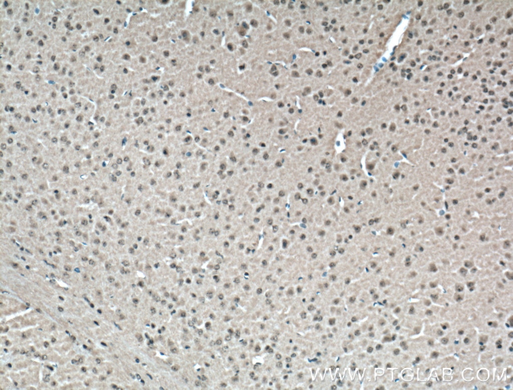 Immunohistochemistry (IHC) staining of mouse brain tissue using CDK10 Polyclonal antibody (17182-1-AP)