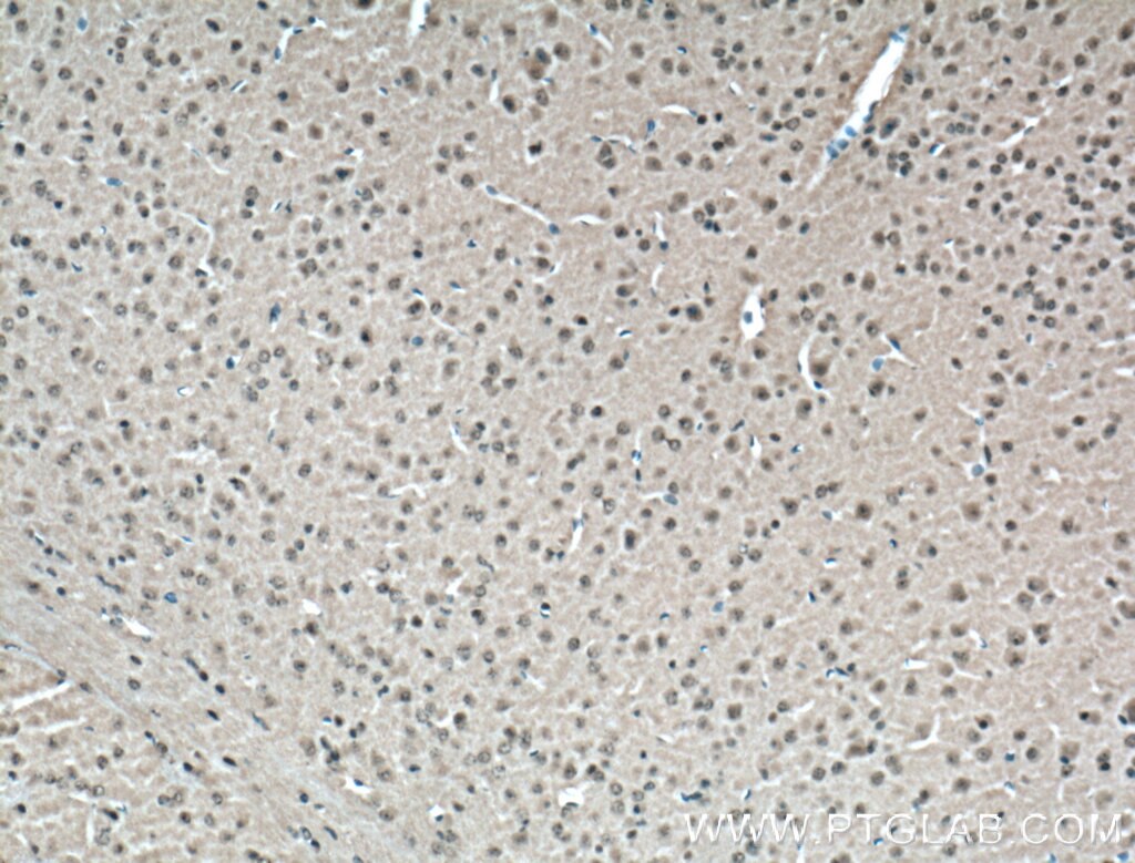 Immunohistochemistry (IHC) staining of mouse brain tissue using CDK10 Polyclonal antibody (17182-1-AP)