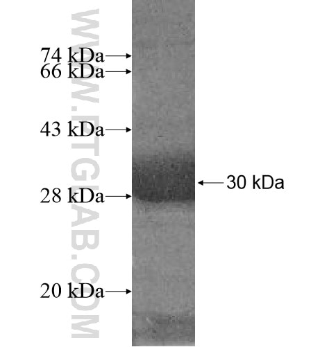 CDK10 fusion protein Ag10935 SDS-PAGE