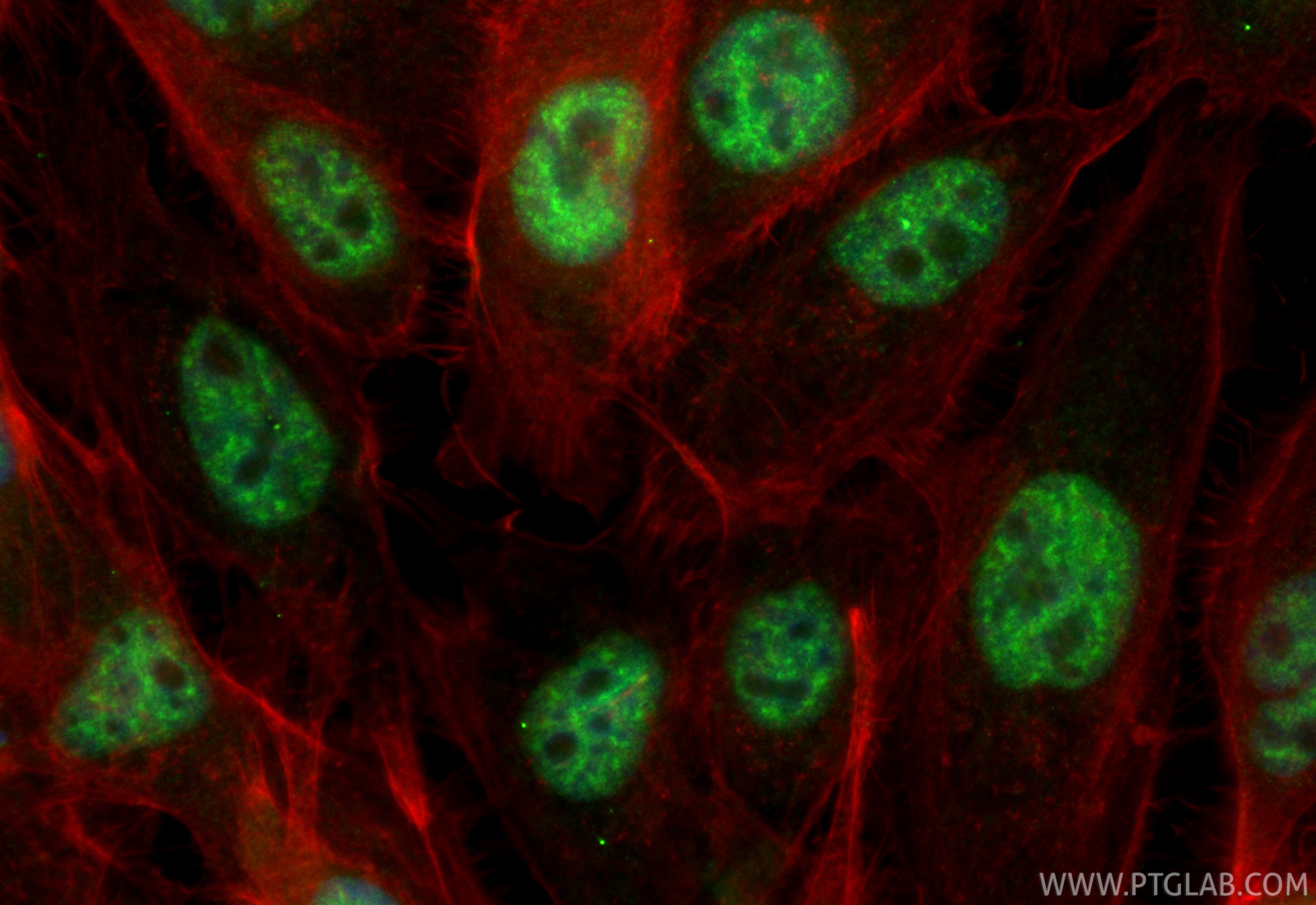 Immunofluorescence (IF) / fluorescent staining of A431 cells using CoraLite® Plus 488-conjugated CDK12/CRKRS Recombin (CL488-86296-3)