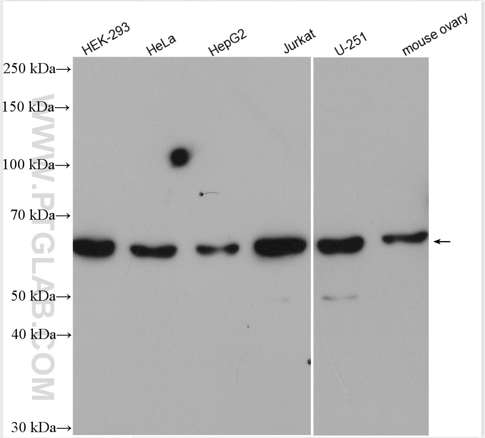 Western Blot (WB) analysis of various lysates using CDK17 Polyclonal antibody (29214-1-AP)