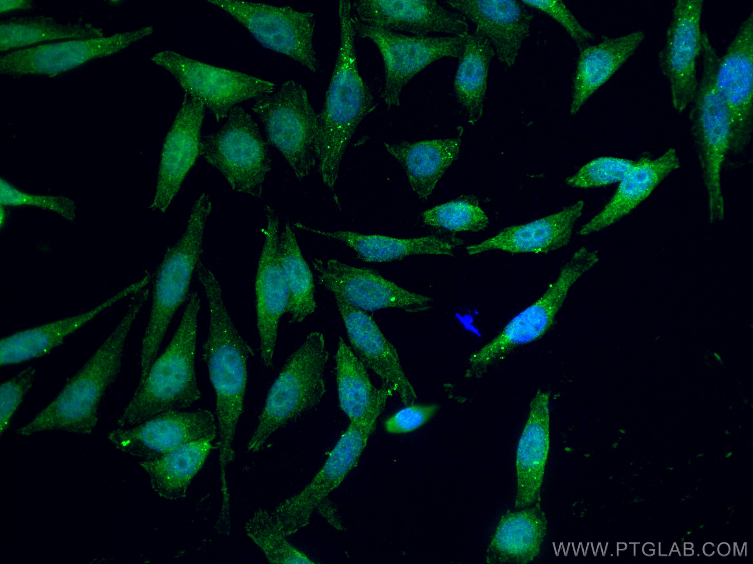 Immunofluorescence (IF) / fluorescent staining of HepG2 cells using CDK2 Polyclonal antibody (10122-1-AP)