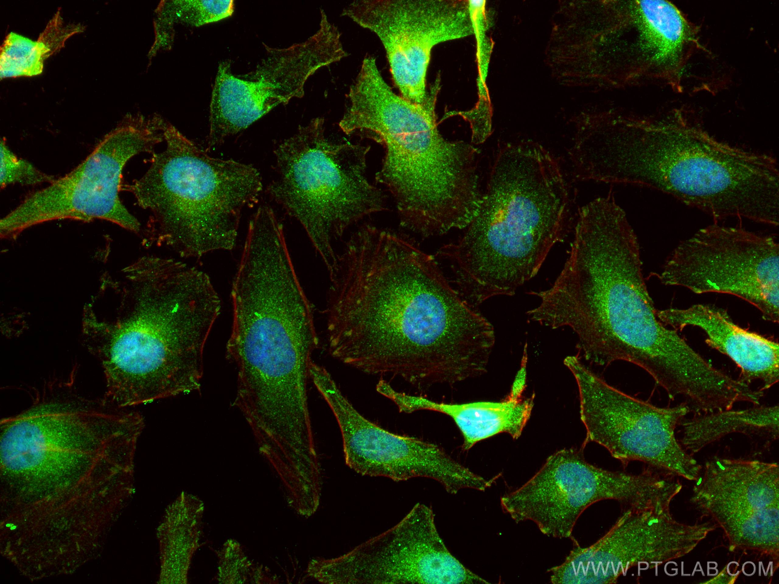Immunofluorescence (IF) / fluorescent staining of HeLa cells using CDK2 Polyclonal antibody (10122-1-AP)
