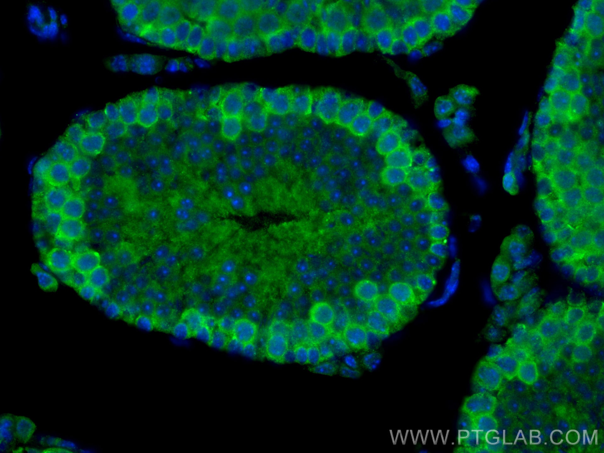 Immunofluorescence (IF) / fluorescent staining of mouse testis tissue using CDK2 Polyclonal antibody (10122-1-AP)