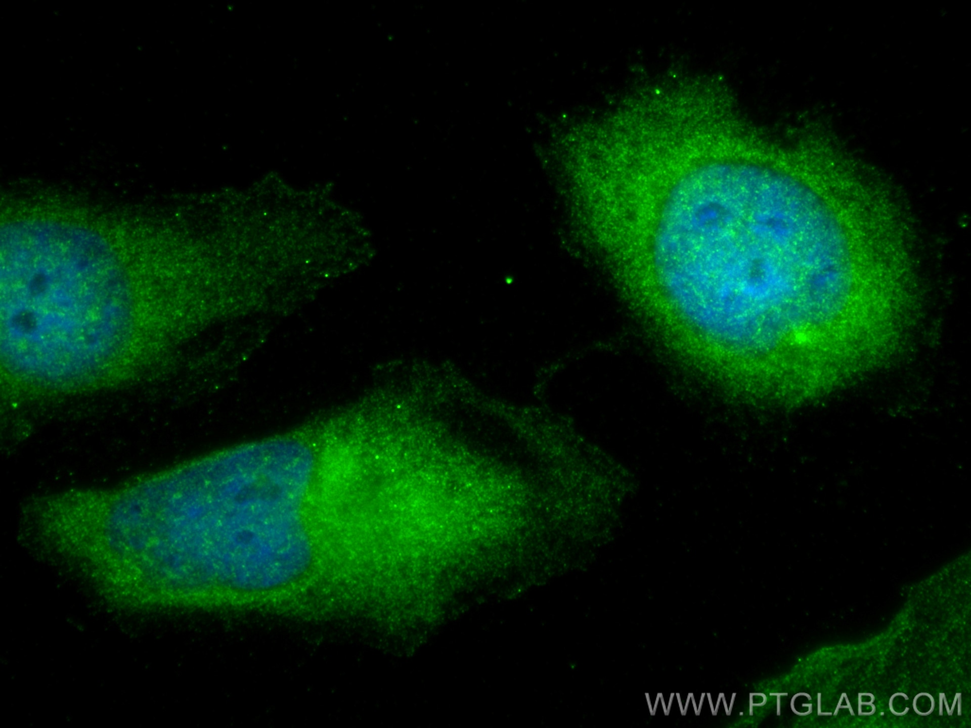 Immunofluorescence (IF) / fluorescent staining of HeLa cells using CDK2 Polyclonal antibody (10122-1-AP)