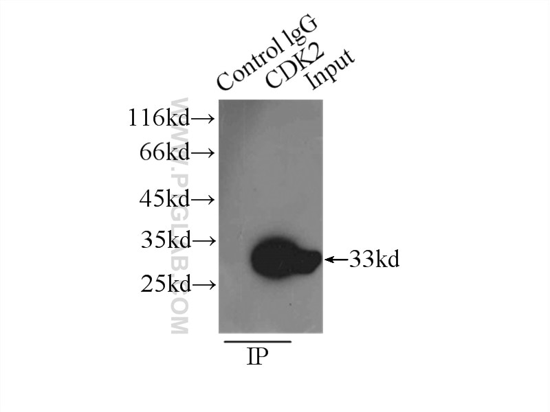Immunoprecipitation (IP) experiment of HeLa cells using CDK2 Polyclonal antibody (10122-1-AP)