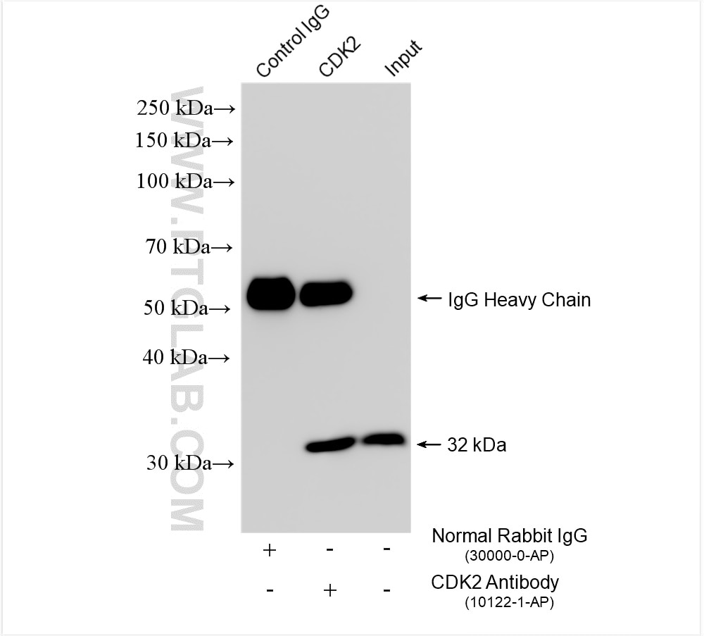 Immunoprecipitation (IP) experiment of HeLa cells using CDK2 Polyclonal antibody (10122-1-AP)